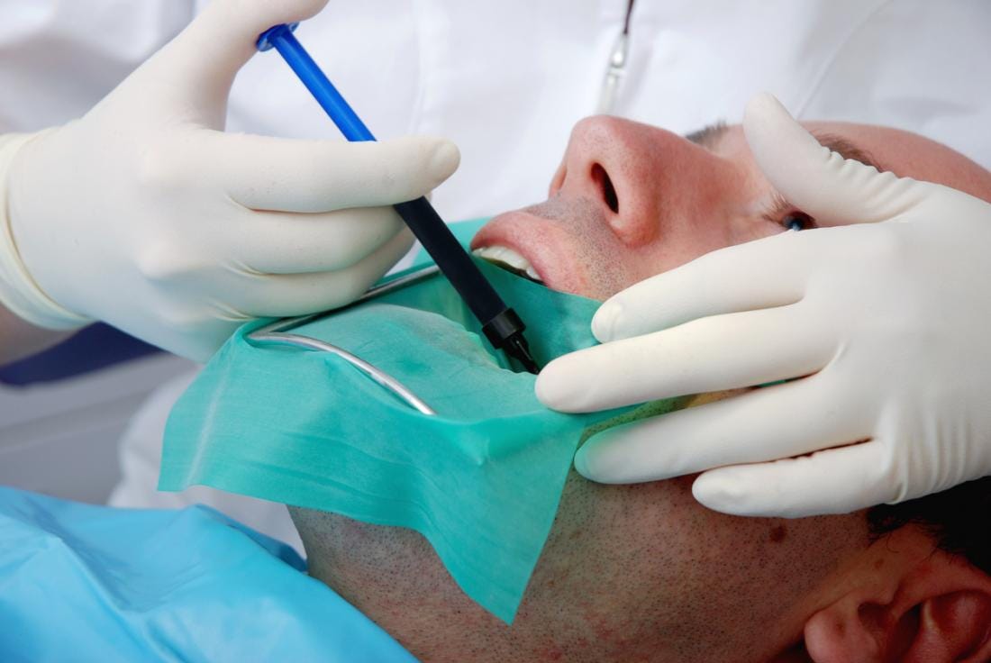 Is Root Canal Treatment Painful? Debunking the Misconceptions